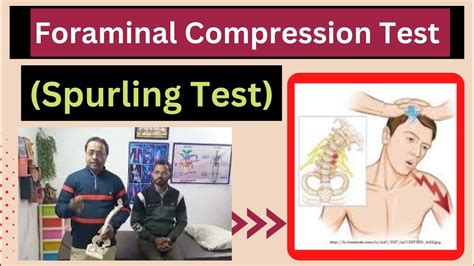 compression test spine|foraminal compression test positive.